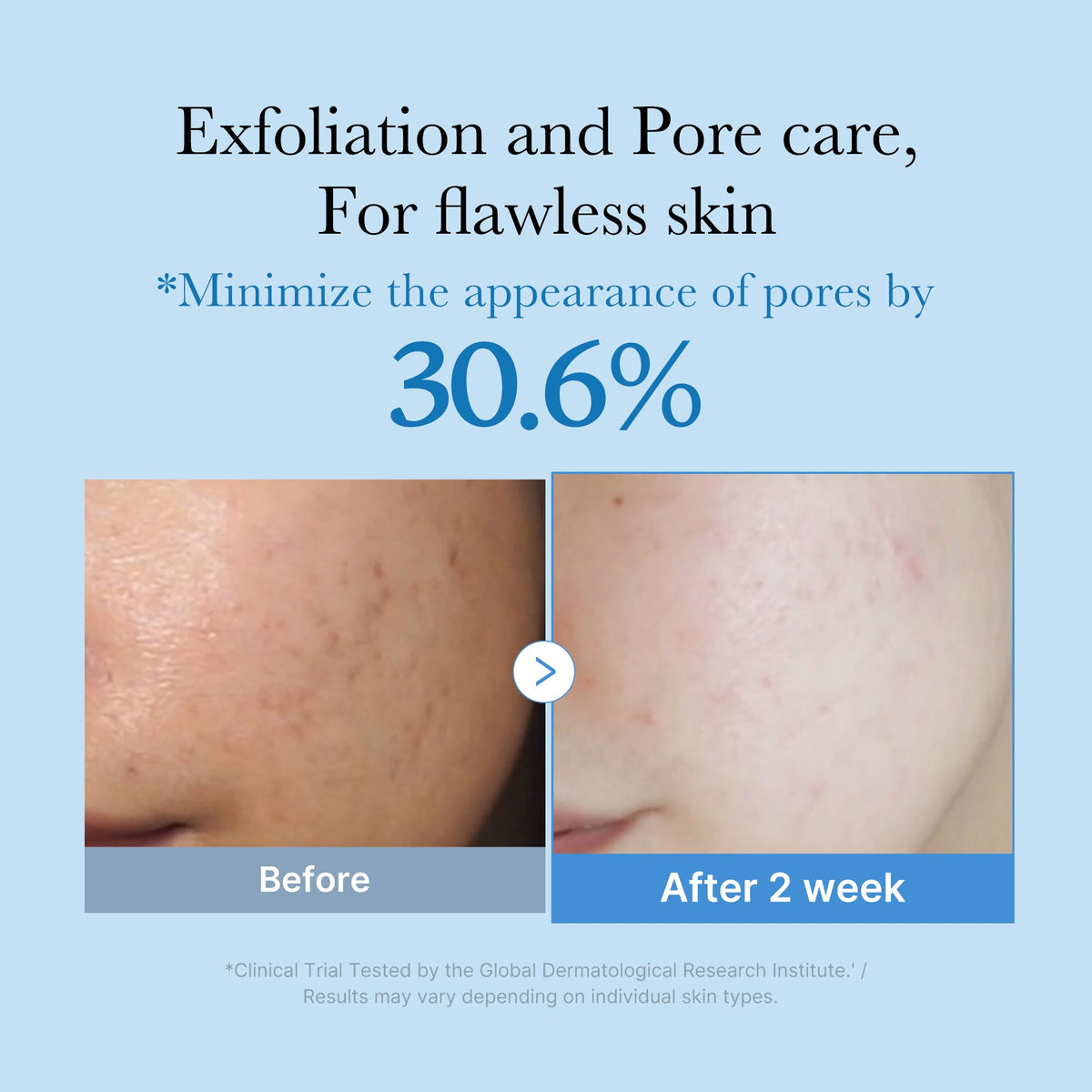 Zero Pore Toner I9