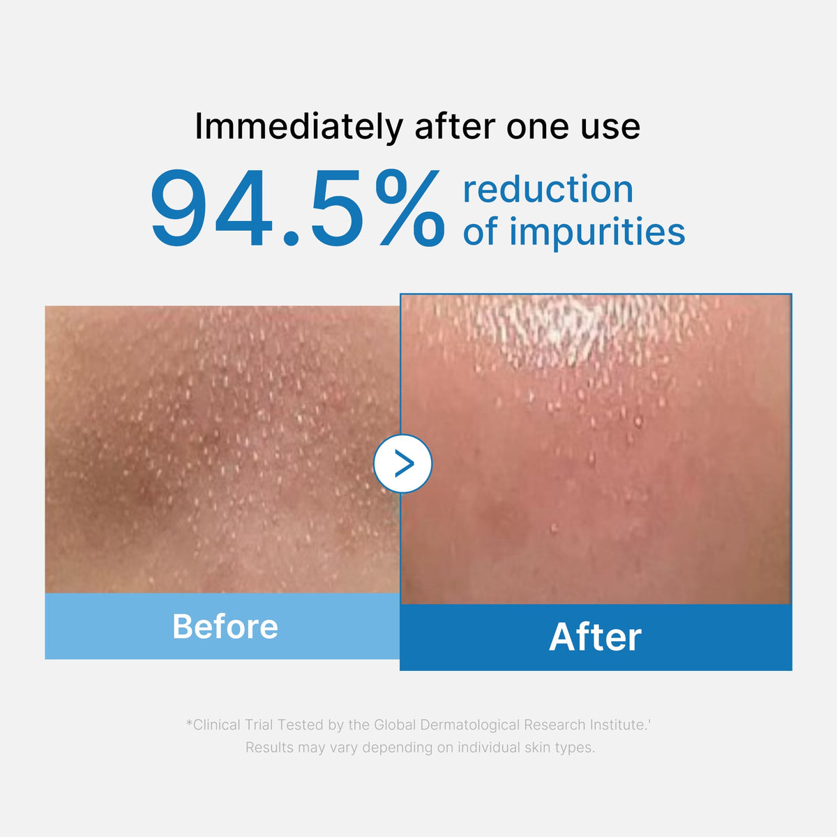 Zero Pore Blackhead Deep Cleansing Oil F5