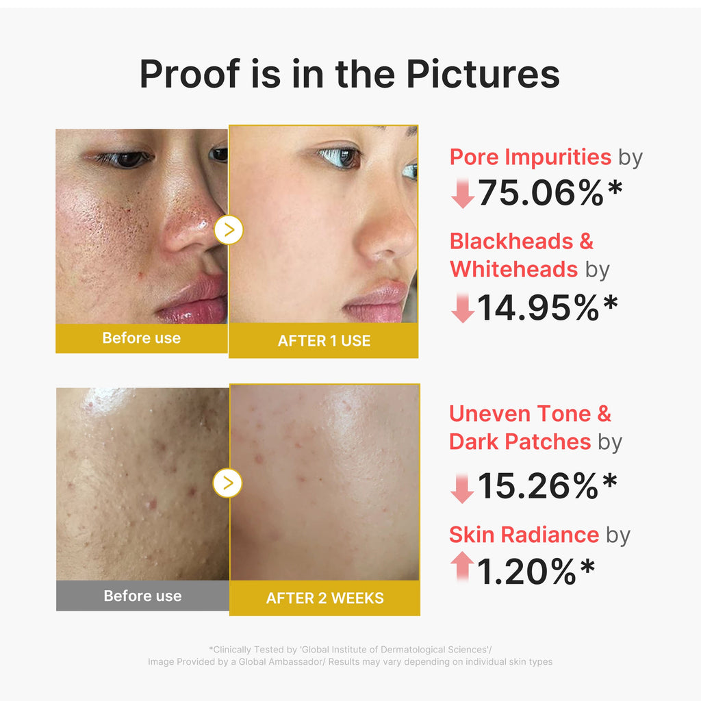 Kojic Acid Turmeric Peel Shot Q3