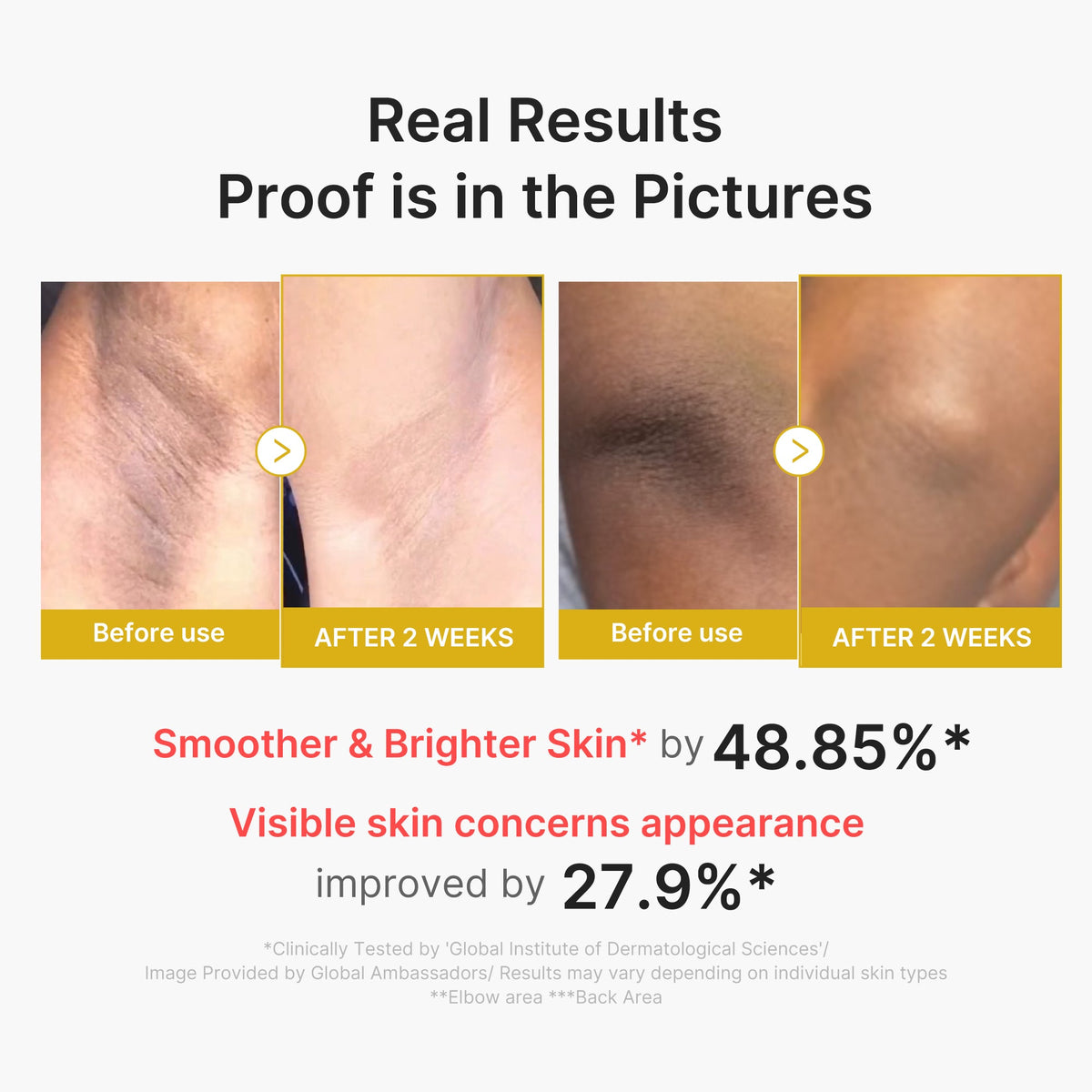 Kojic Acid Turmeric Body Peel Shot T3