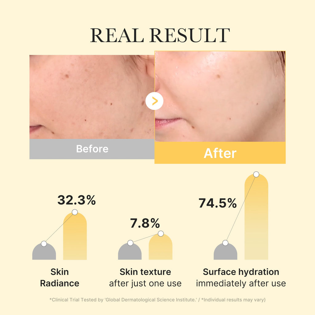 Kojic Acid Turmeric Gold Jelly Gel Mask B4