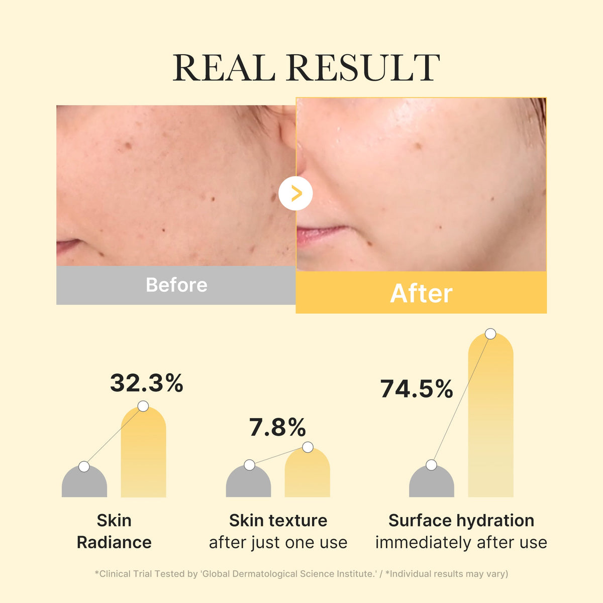 Kojic Acid Turmeric Gold Jelly Gel Mask B4