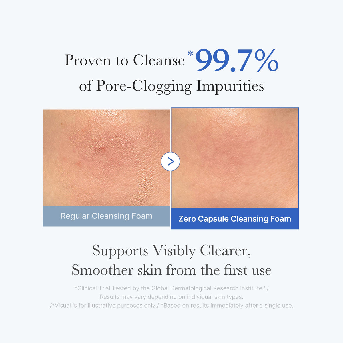 Zero Pore Capsule Cleansing Foam A0
