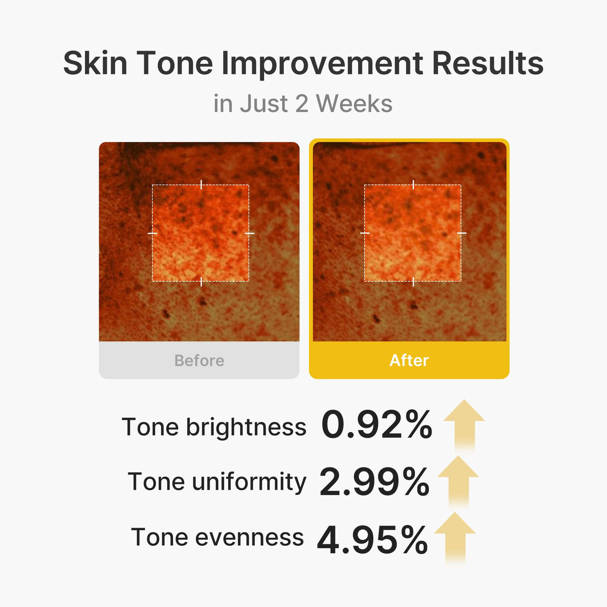 Kojic Acid Turmeric Vita Capsule Cream K9
