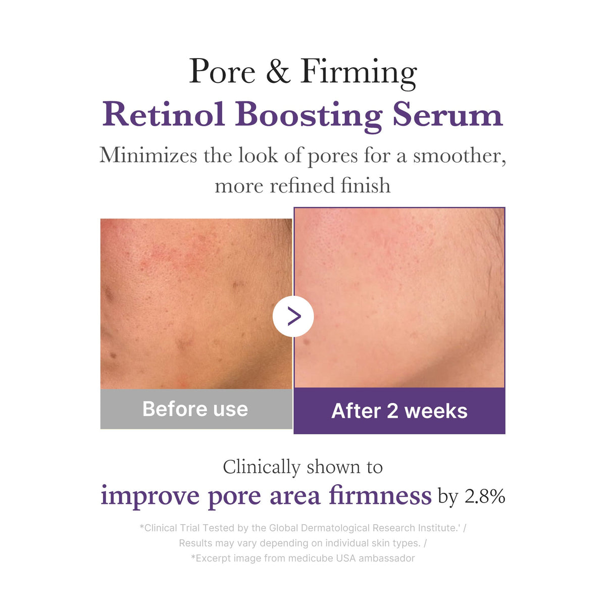 Retinol NMN Boosting Serum I3