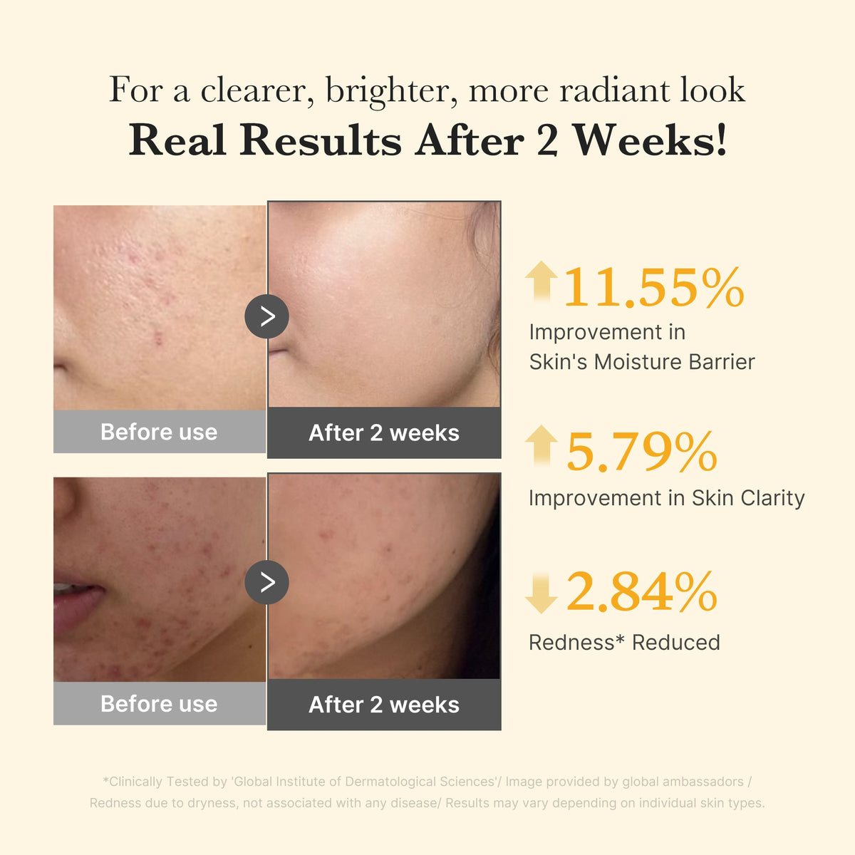 Kojic Acid Turmeric Capsule Serum M3