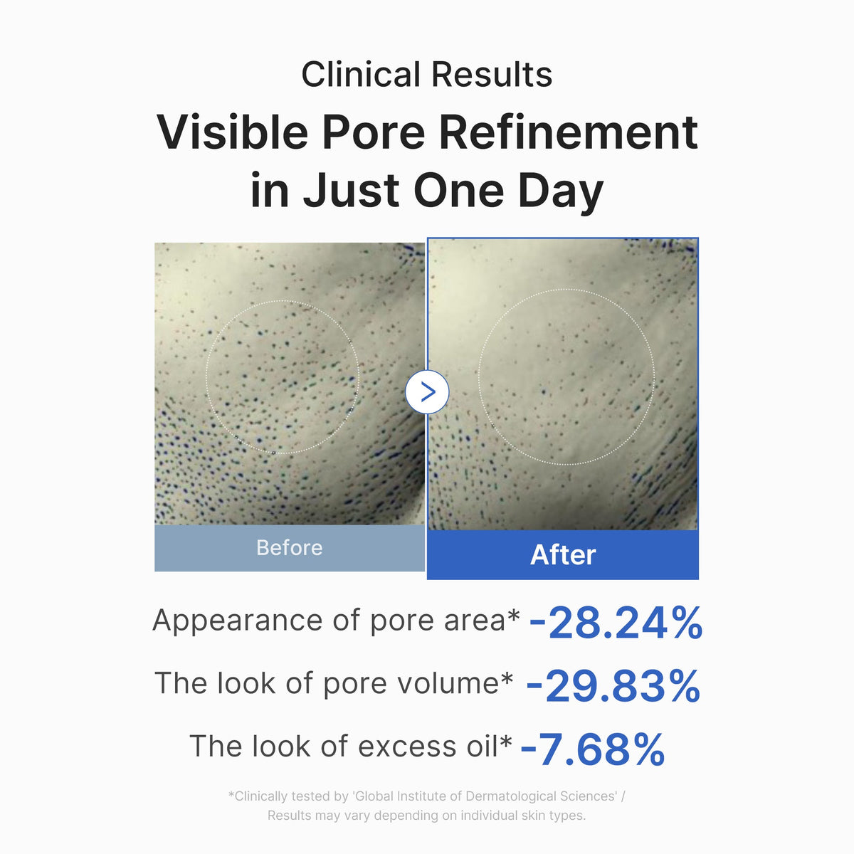 Zero Pore One-day Peptide Serum B2