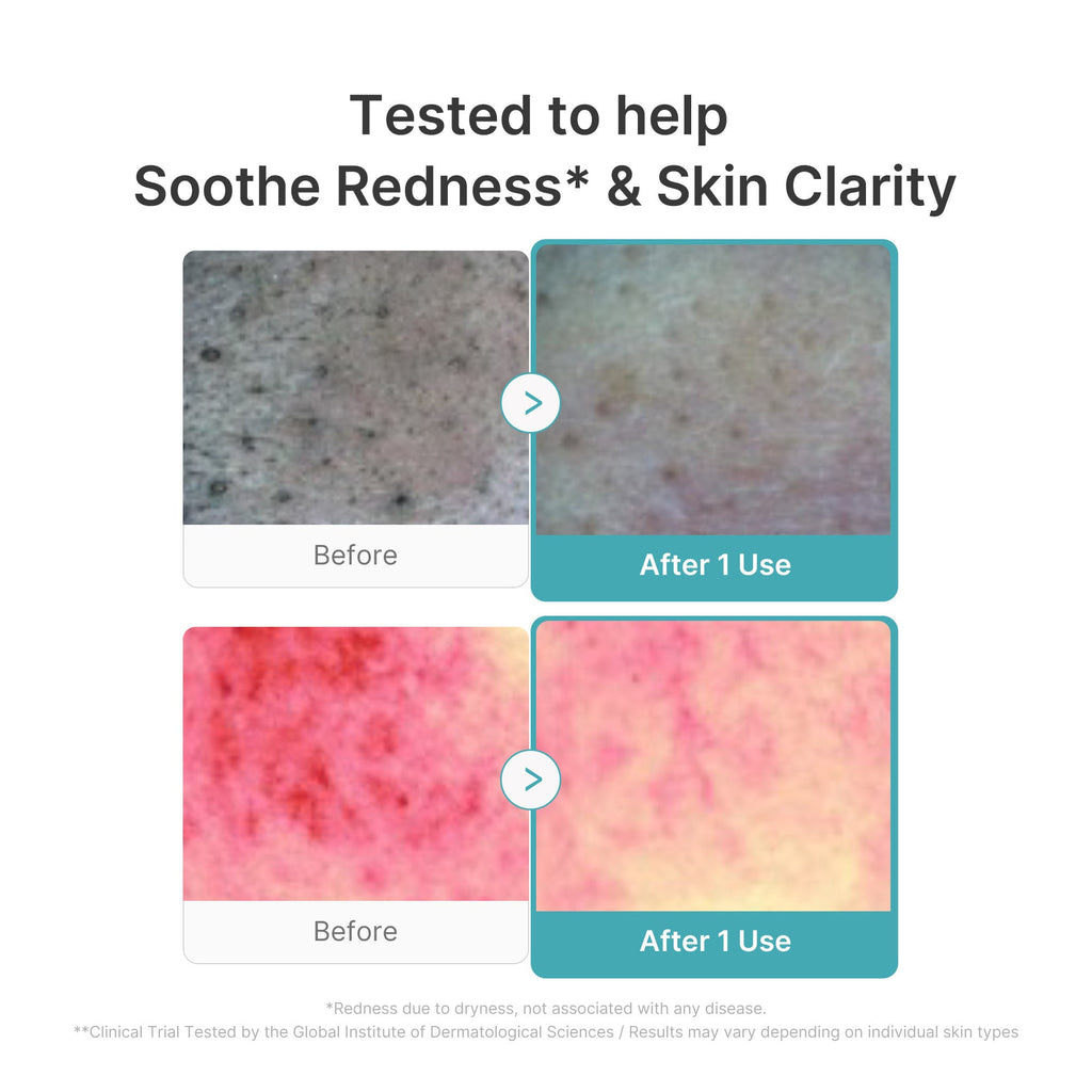 Azelaic Acid Capsule Foam Cleanser F8
