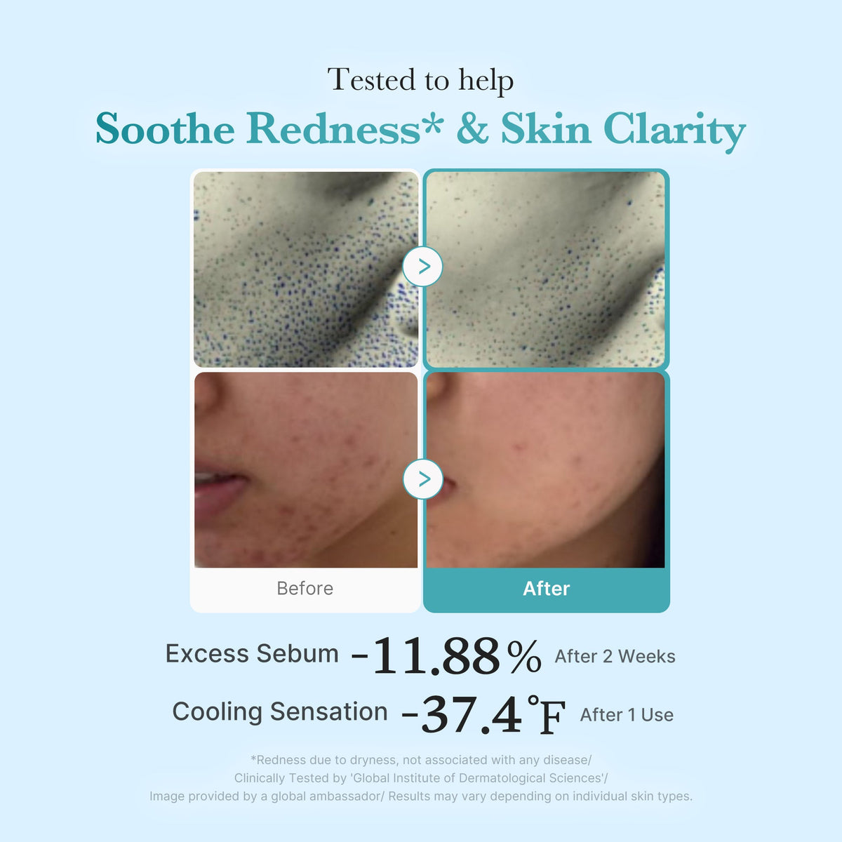 Azelaic Acid Niacinamide Clarifying Toner M4