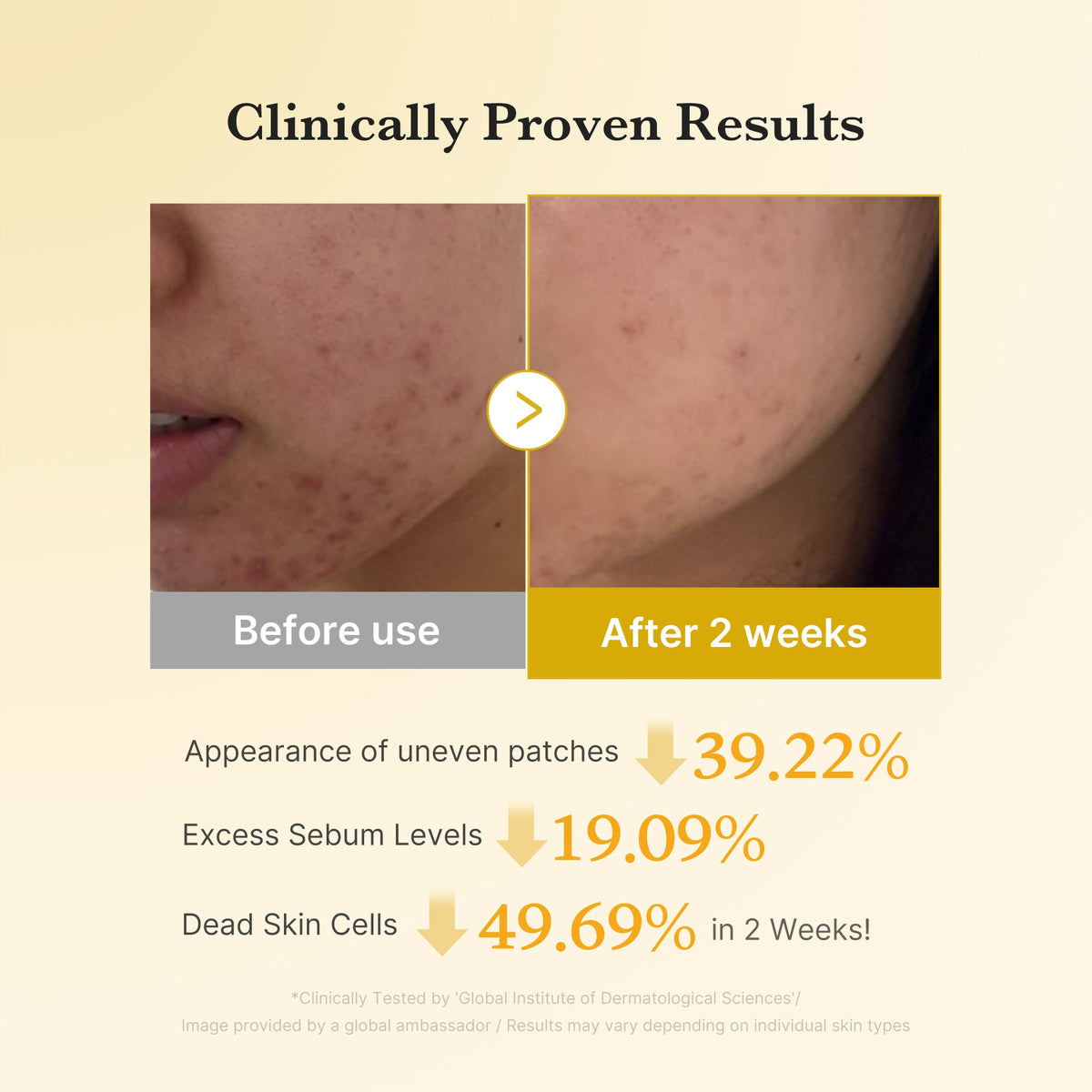 Kojic Acid Tumeric Toner Pad H1
