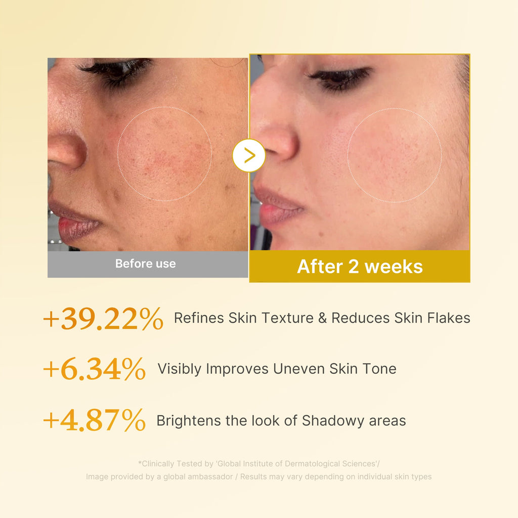 Kojic Acid Turmeric Toner U7