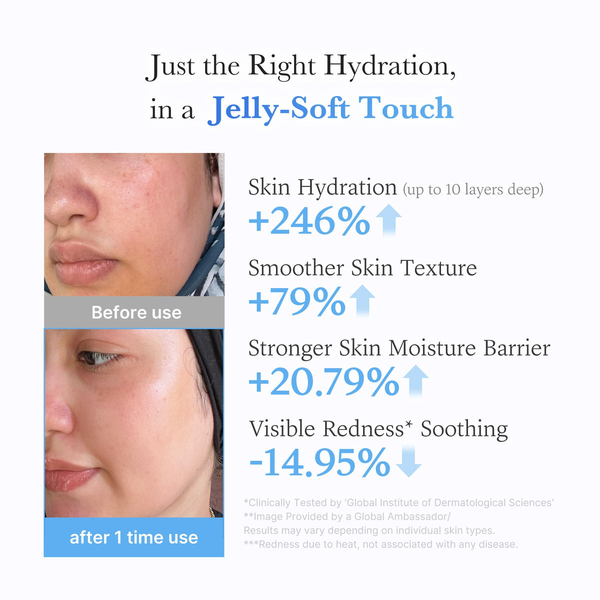 Hyaluronic Ceramide Moisturizing Jelly Cream Q1