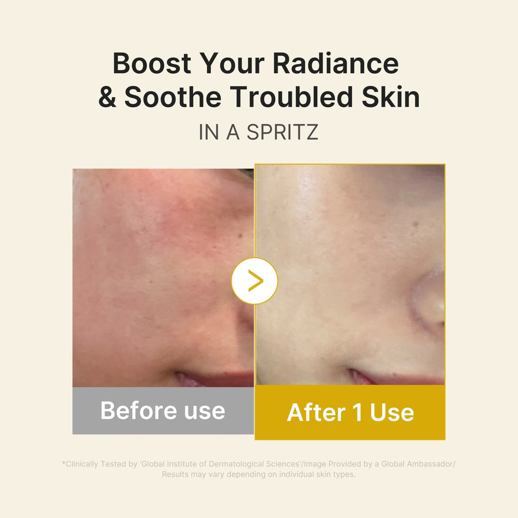 Kojic Acid Turmeric Vitamin Gold Jelly Mist Serum V4