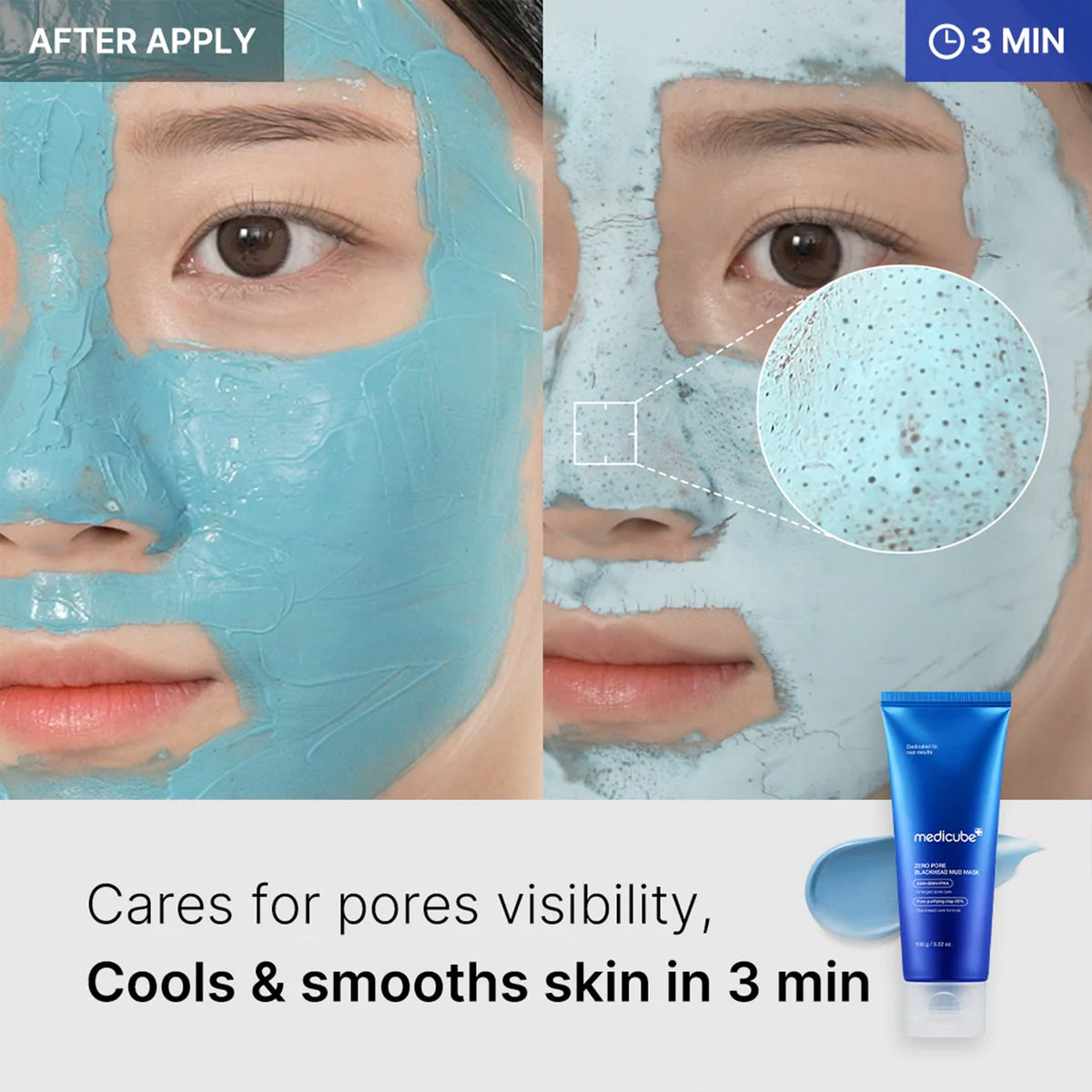 Zero Pore Blackhead Mud Mask L4
