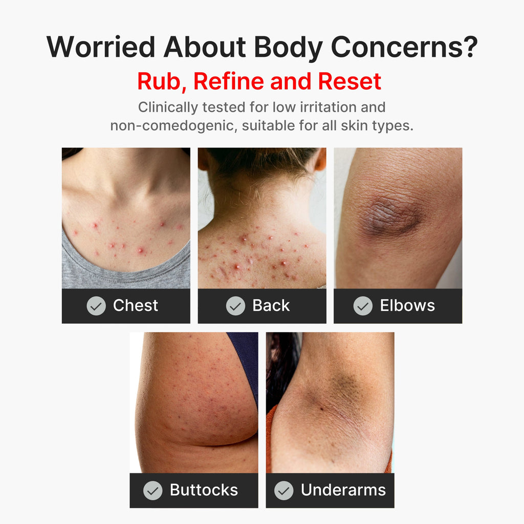 Kojic Acid Turmeric Body Peel Shot T3