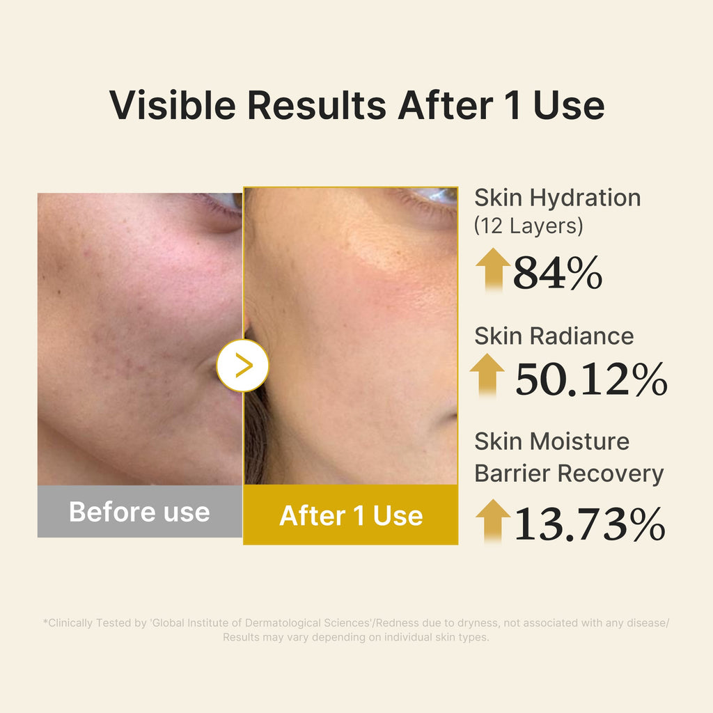 Kojic Acid Turmeric Vitamin Gold Jelly Mist Serum V4