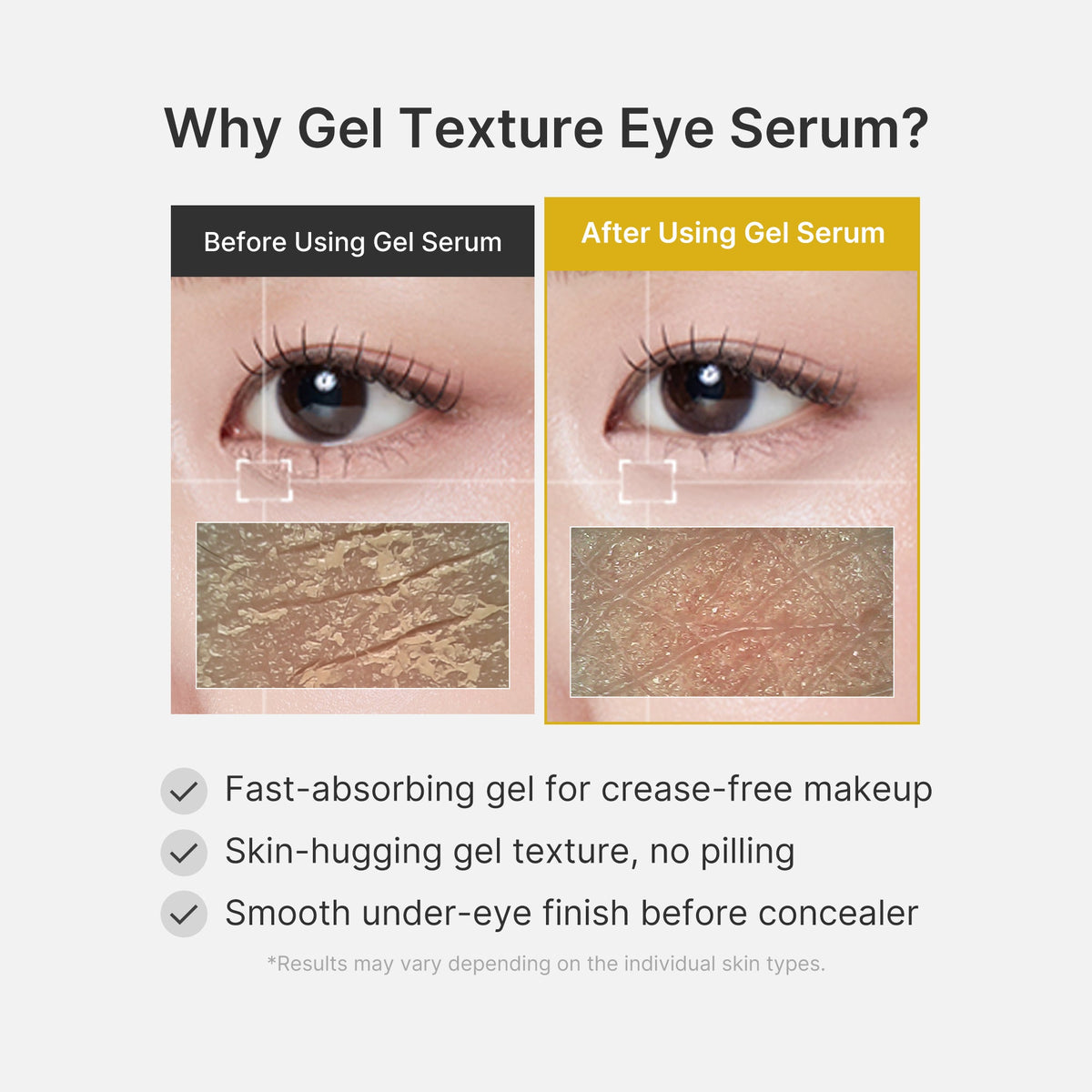 Kojic Acid Tumeric Eye Gel Serum B1