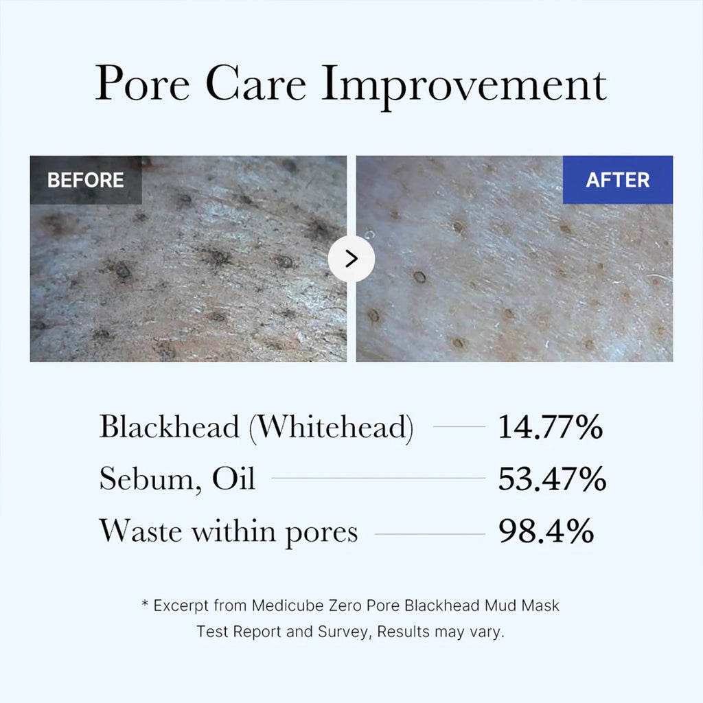 Zero Pore Blackhead Mud Mask L4