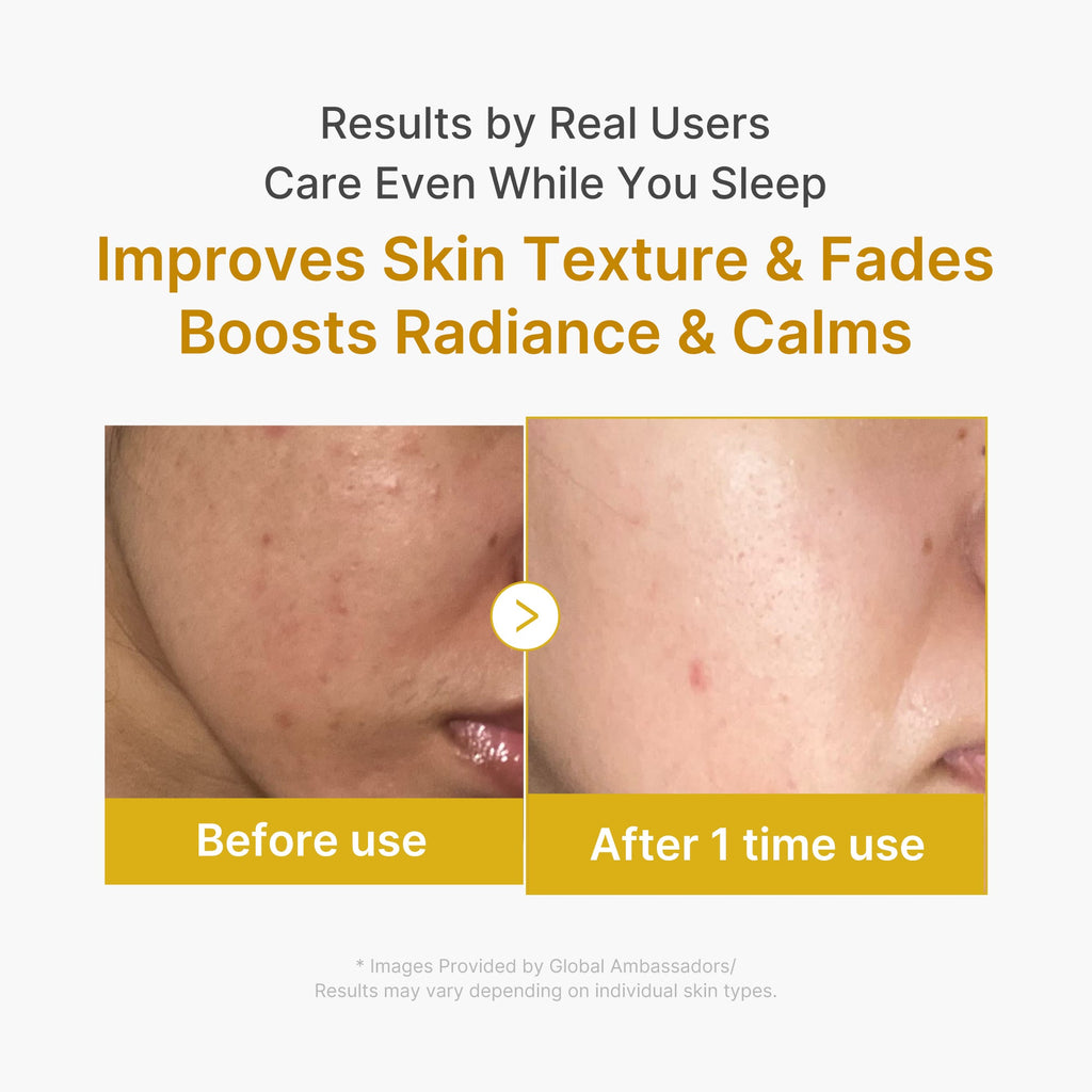 Kojic Acid Turmeric Overnight Wrapping Mask G3