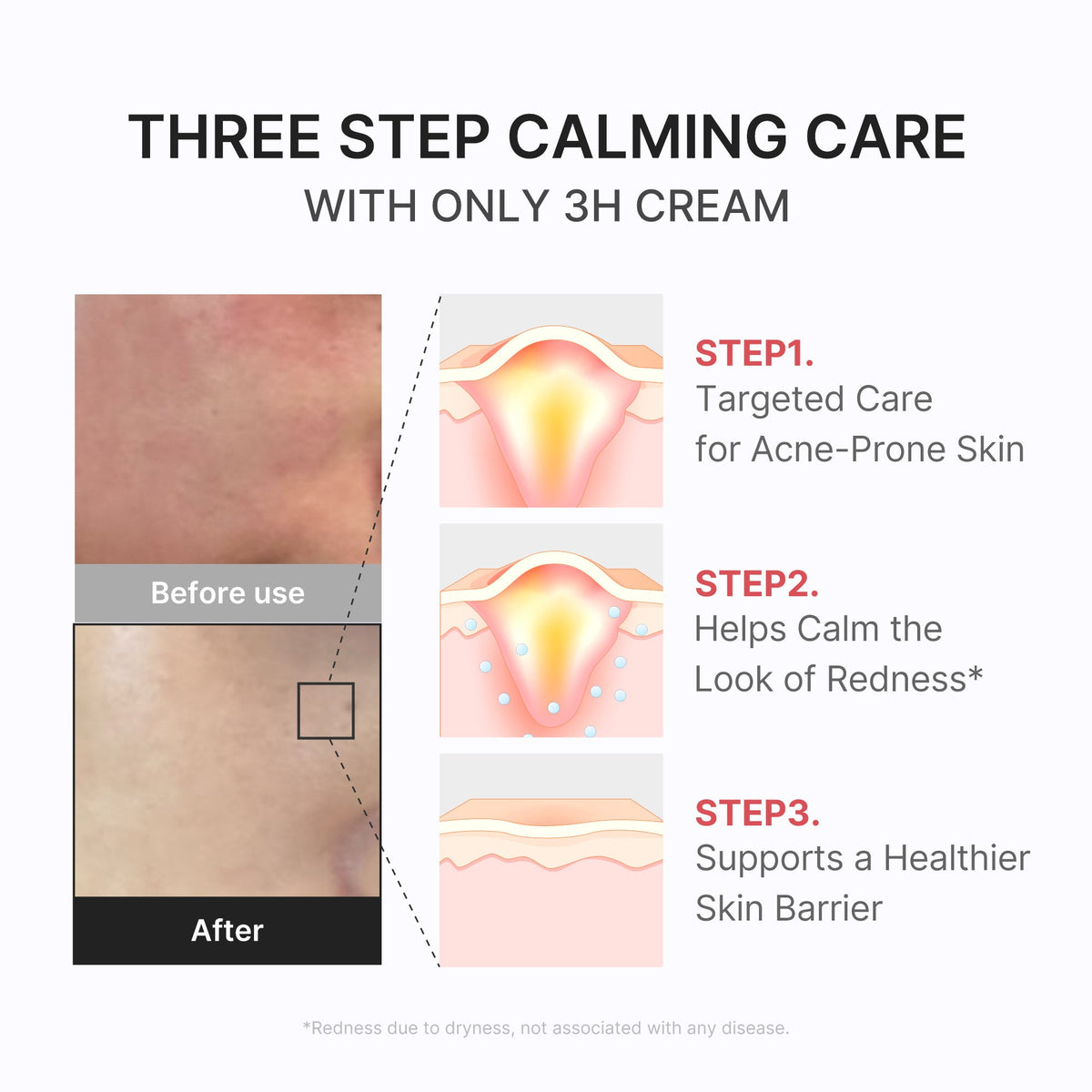 3H Daily Relief Cream D0