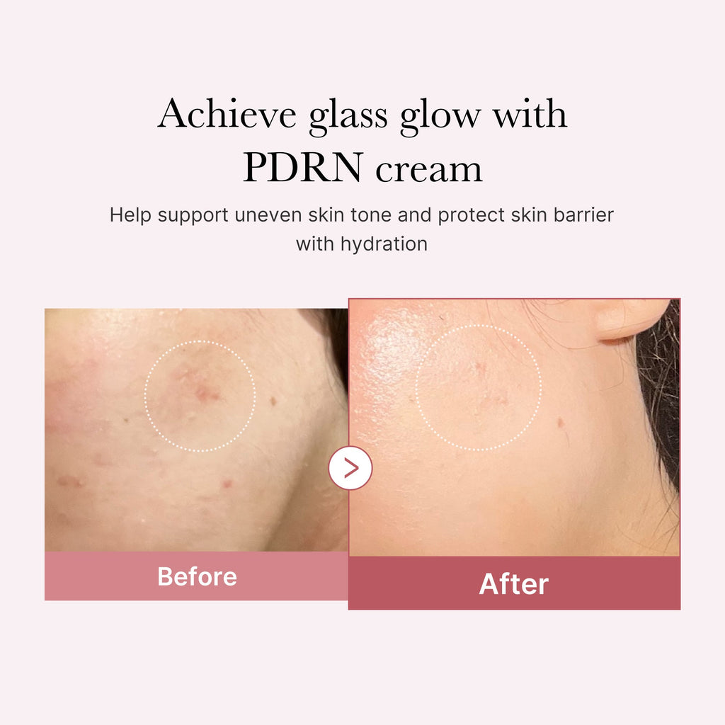 PDRN Pink Peptide Cream Q7