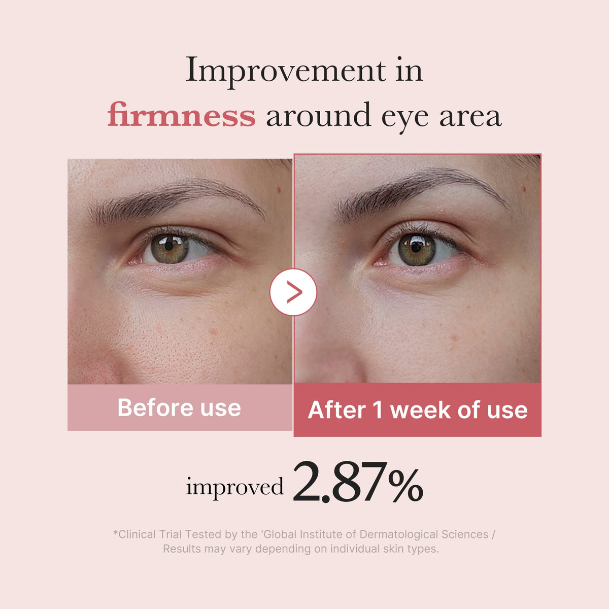 PDRN Pink Peptide Eye Cream K6