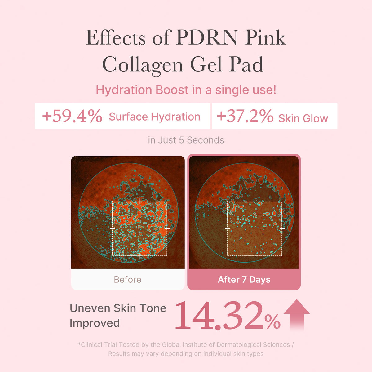 PDRN Pink Collagen Gel Toner Pad W9