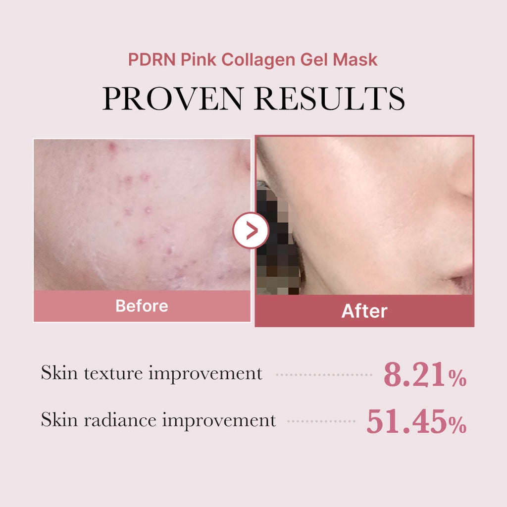 Salmon PDRN Pink Collagen Jelly Gel Mask H5