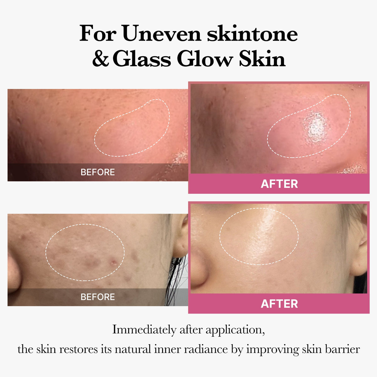 [Tati's Exclusive] All About Glow Set Y6
